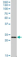 Western blot - Anti-Lipocalin-2 / NGAL antibody (AB89819)