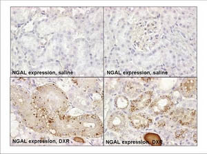 Immunohistochemistry (Formalin/PFA-fixed paraffin-embedded sections) - Anti-Lipocalin-2 / NGAL antibody [ABS 039-08] (AB53500)