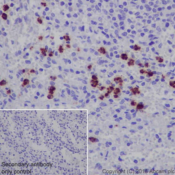 Immunohistochemistry (Formalin/PFA-fixed paraffin-embedded sections) - Anti-Lipocalin-2 / NGAL antibody [EPR19912] (AB206427)