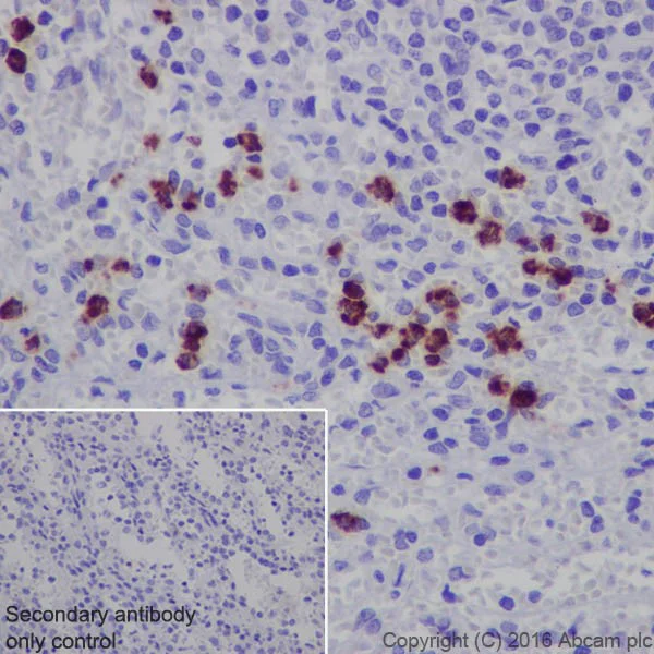 Immunohistochemistry (Formalin/PFA-fixed paraffin-embedded sections) - Anti-Lipocalin-2 / NGAL antibody [EPR19912] (AB206427)
