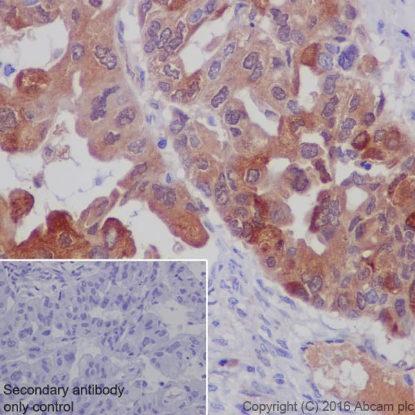 Immunohistochemistry (Formalin/PFA-fixed paraffin-embedded sections) - Anti-Lipocalin-2 / NGAL antibody [EPR19912] (AB206427)