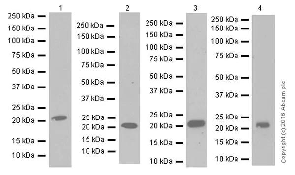 Western blot - Anti-Lipocalin-2 / NGAL antibody [EPR19912] (AB206427)