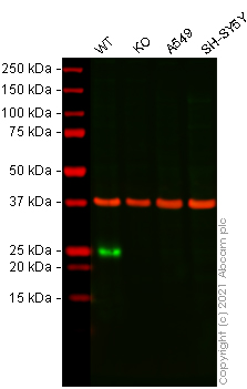 Western blot - Anti-Lipocalin-2 / NGAL antibody [EPR19912] - Low endotoxin, Azide free (AB224264)
