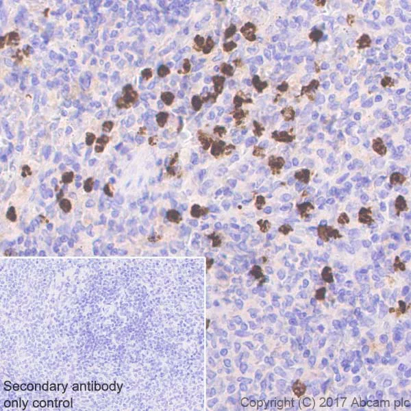 Immunohistochemistry (Formalin/PFA-fixed paraffin-embedded sections) - Anti-Lipocalin-2 / NGAL antibody [EPR21092] (AB216462)