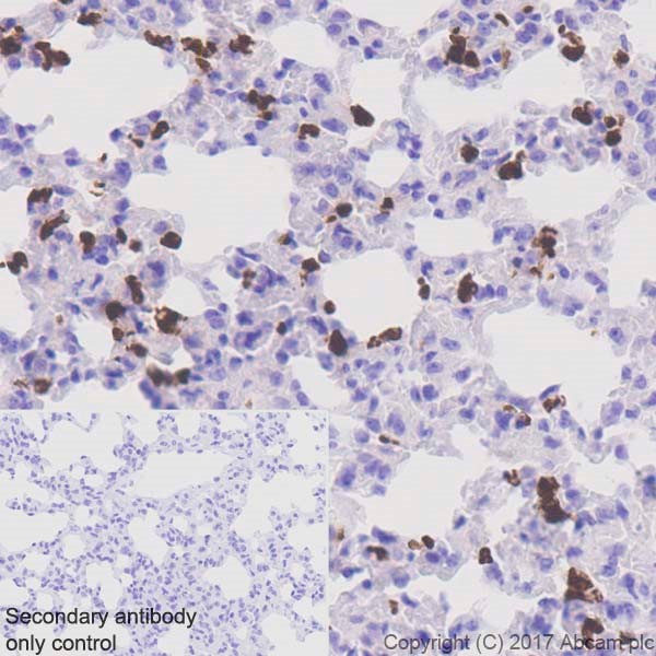 Immunohistochemistry (Formalin/PFA-fixed paraffin-embedded sections) - Anti-Lipocalin-2 / NGAL antibody [EPR21092] (AB216462), expandable thumbnail