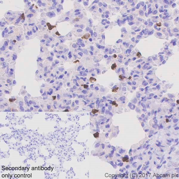 Immunohistochemistry (Formalin/PFA-fixed paraffin-embedded sections) - Anti-Lipocalin-2 / NGAL antibody [EPR21092] (AB216462), expandable thumbnail