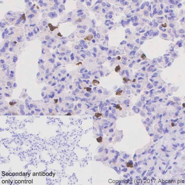 Immunohistochemistry (Formalin/PFA-fixed paraffin-embedded sections) - Anti-Lipocalin-2 / NGAL antibody [EPR21092] (AB216462)