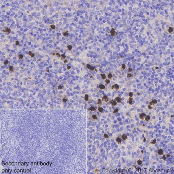 Immunohistochemistry (Formalin/PFA-fixed paraffin-embedded sections) - Anti-Lipocalin-2 / NGAL antibody [EPR21092] (AB216462), expandable thumbnail