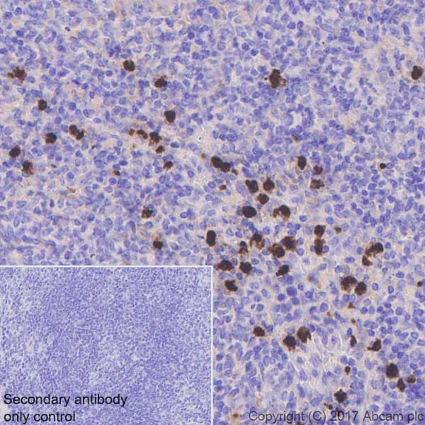 Immunohistochemistry (Formalin/PFA-fixed paraffin-embedded sections) - Anti-Lipocalin-2 / NGAL antibody [EPR21092] (AB216462)
