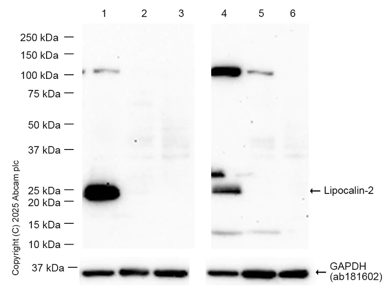 Western blot - Anti-Lipocalin-2 / NGAL antibody [EPR21092] (AB216462)