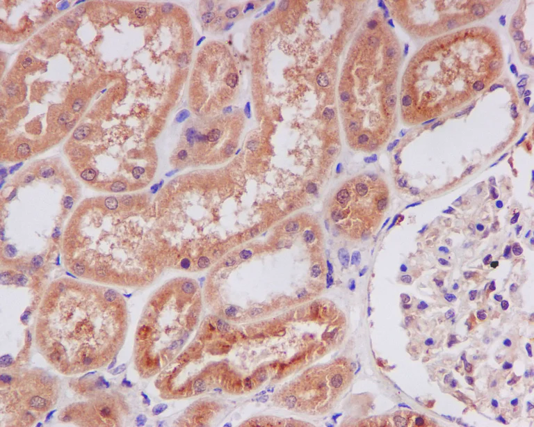 Immunohistochemistry (Formalin/PFA-fixed paraffin-embedded sections) - Anti-Lipocalin-2 / NGAL antibody [EPR5084] - BSA and Azide free (AB187969)