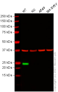 Western blot - Anti-Lipocalin-2 / NGAL antibody [EPR5084] - BSA and Azide free (AB187969), expandable thumbnail