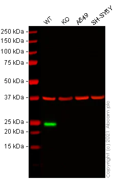 Western blot - Anti-Lipocalin-2 / NGAL antibody [EPR5084] - BSA and Azide free (AB187969)