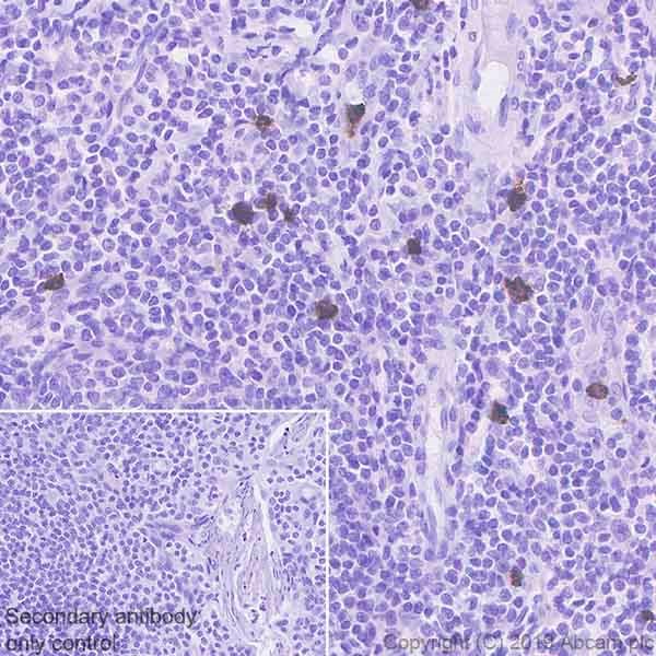 Immunohistochemistry (Formalin/PFA-fixed paraffin-embedded sections) - Anti-Lipocalin-2 / NGAL antibody [HAT265B] (AB241562)