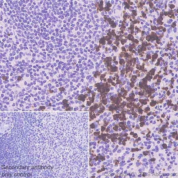 Immunohistochemistry (Formalin/PFA-fixed paraffin-embedded sections) - Anti-Lipocalin-2 / NGAL antibody [HAT265B] (AB241562)
