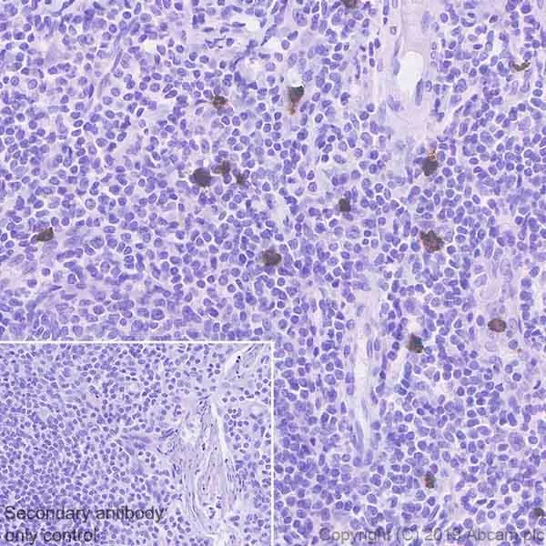 Immunohistochemistry (Formalin/PFA-fixed paraffin-embedded sections) - Anti-Lipocalin-2 / NGAL antibody [HAT265B] - BSA and Azide free (AB255752)
