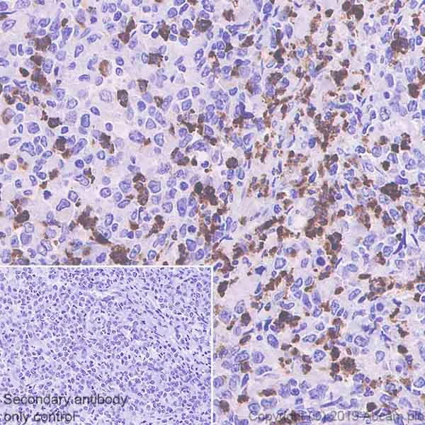 Immunohistochemistry (Formalin/PFA-fixed paraffin-embedded sections) - Anti-Lipocalin-2 / NGAL antibody [HAT265B] - BSA and Azide free (AB255752)