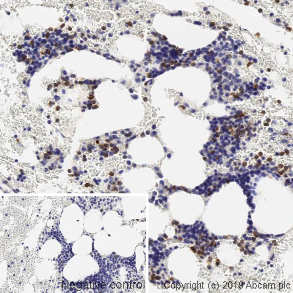 Immunohistochemistry (Formalin/PFA-fixed paraffin-embedded sections) - Anti-Lipocalin-2 / NGAL antibody [HAT265B] - BSA and Azide free (AB255752)