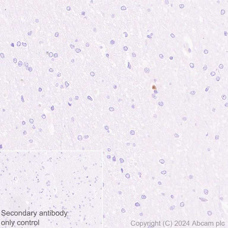 Immunohistochemistry (Formalin/PFA-fixed paraffin-embedded sections) - Anti-Lipocalin-2 / NGAL antibody [RM1211] (AB318209)