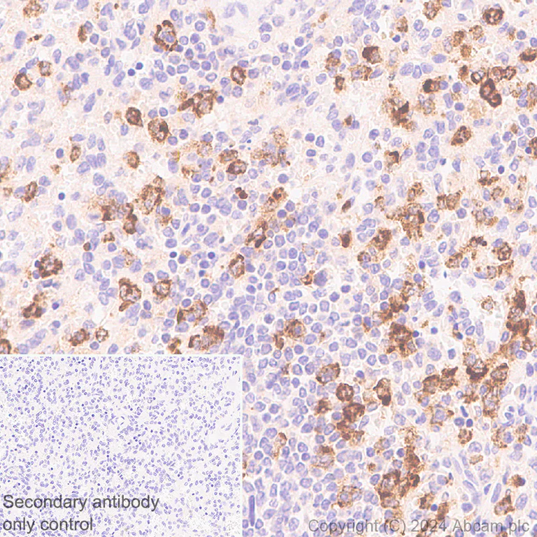 Immunohistochemistry (Formalin/PFA-fixed paraffin-embedded sections) - Anti-Lipocalin-2 / NGAL antibody [RM1211] - BSA and Azide free (AB318210)
