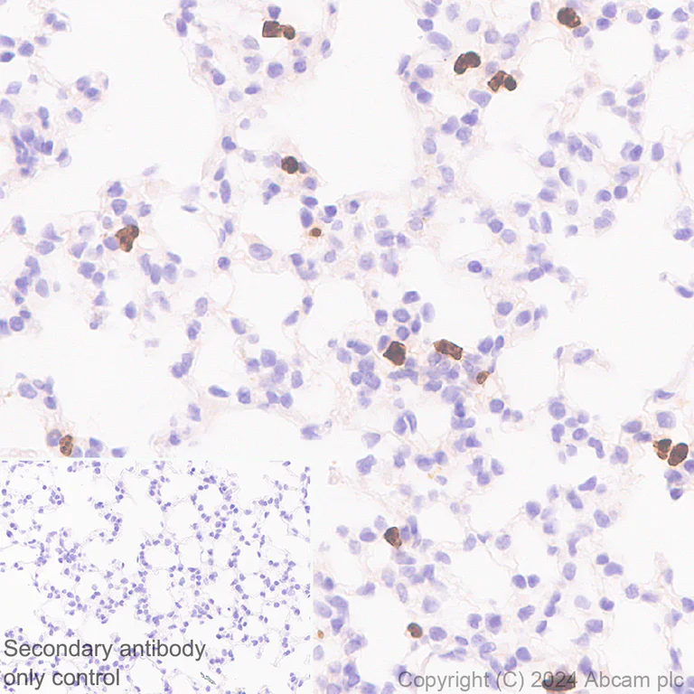 Immunohistochemistry (Formalin/PFA-fixed paraffin-embedded sections) - Anti-Lipocalin-2 / NGAL antibody [RM1211] - BSA and Azide free (AB318210)