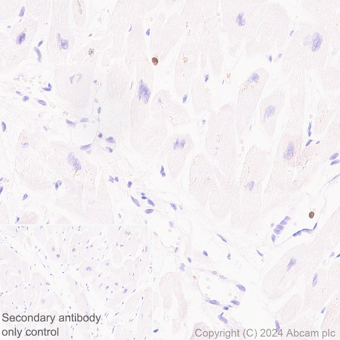 Immunohistochemistry (Formalin/PFA-fixed paraffin-embedded sections) - Anti-Lipocalin-2 / NGAL antibody [RM1211] - BSA and Azide free (AB318210)