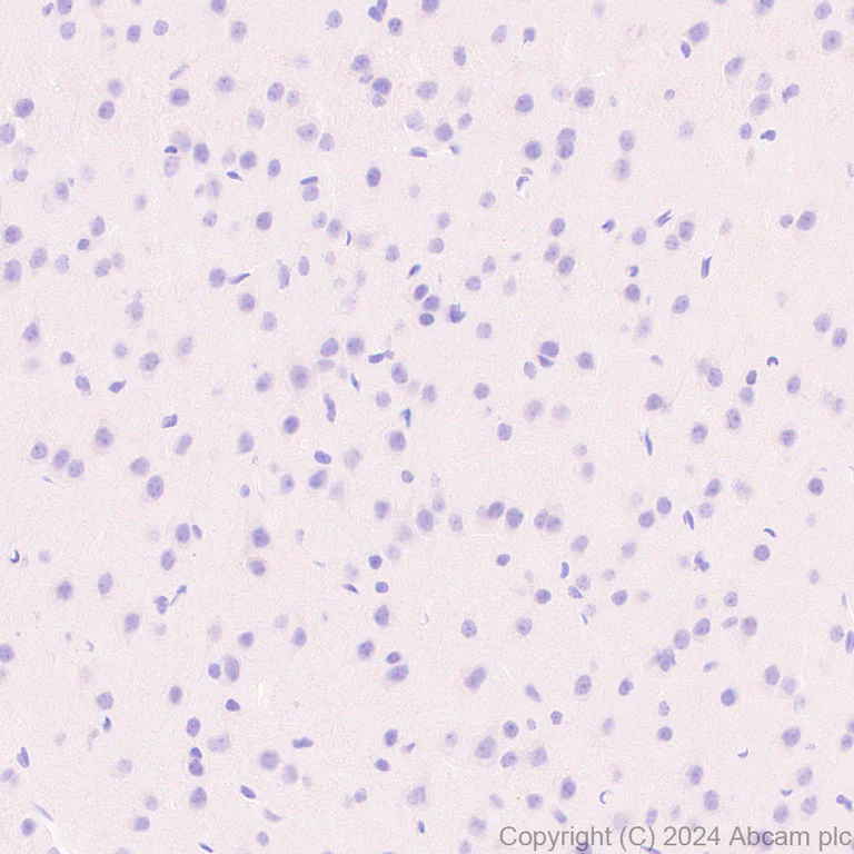 Immunohistochemistry (Formalin/PFA-fixed paraffin-embedded sections) - Anti-Lipocalin-2 / NGAL antibody [RM1211] - BSA and Azide free (AB318210)