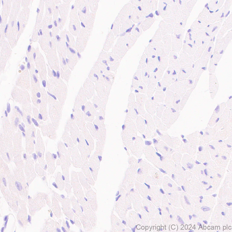 Immunohistochemistry (Formalin/PFA-fixed paraffin-embedded sections) - Anti-Lipocalin-2 / NGAL antibody [RM1211] - BSA and Azide free (AB318210)