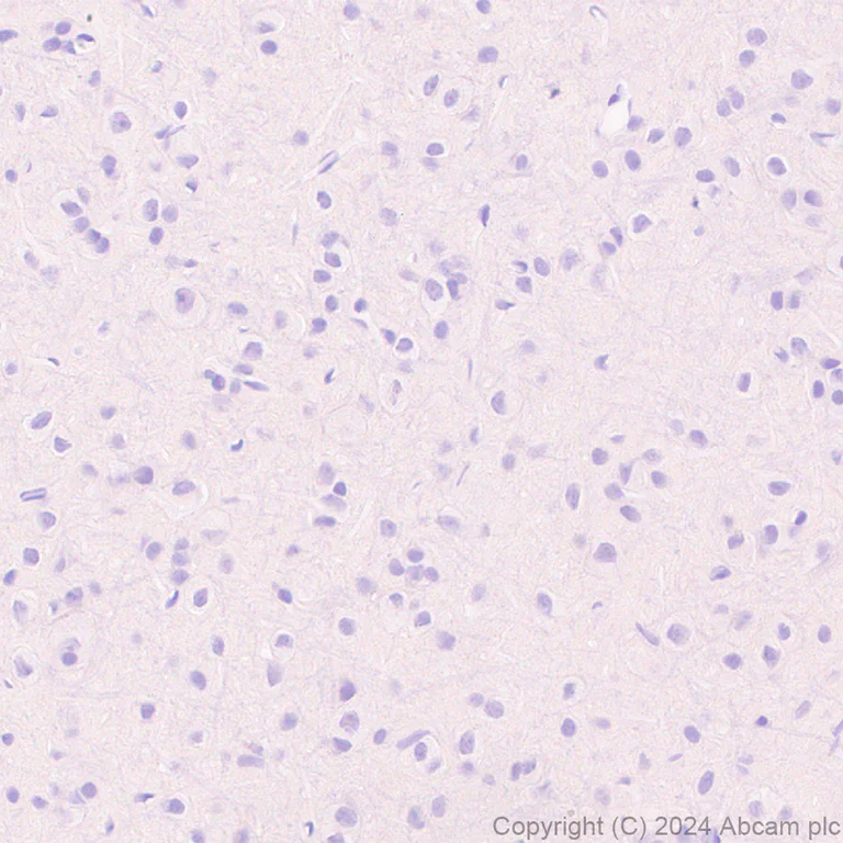 Immunohistochemistry (Formalin/PFA-fixed paraffin-embedded sections) - Anti-Lipocalin-2 / NGAL antibody [RM1211] - BSA and Azide free (AB318210)