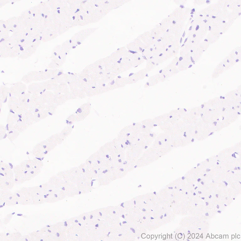 Immunohistochemistry (Formalin/PFA-fixed paraffin-embedded sections) - Anti-Lipocalin-2 / NGAL antibody [RM1211] - BSA and Azide free (AB318210)
