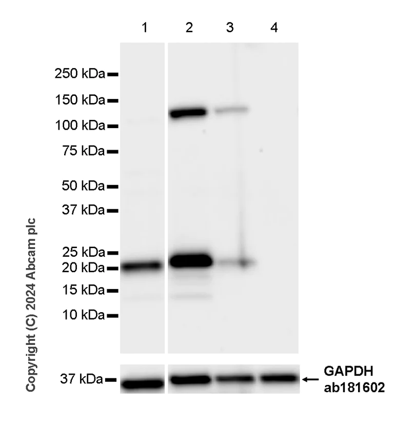 Western blot - Anti-Lipocalin-2 / NGAL antibody [RM1211] - BSA and Azide free (AB318210)