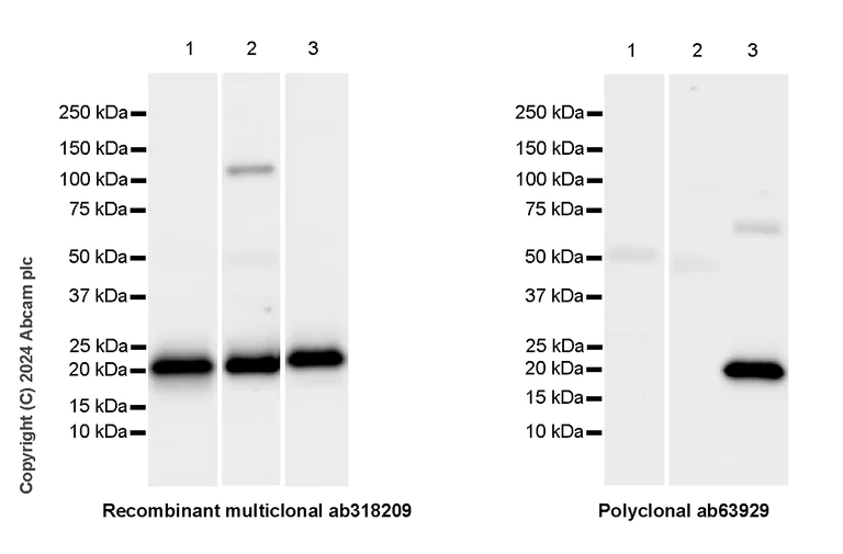 Western blot - Anti-Lipocalin-2 / NGAL antibody [RM1211] - BSA and Azide free (AB318210)