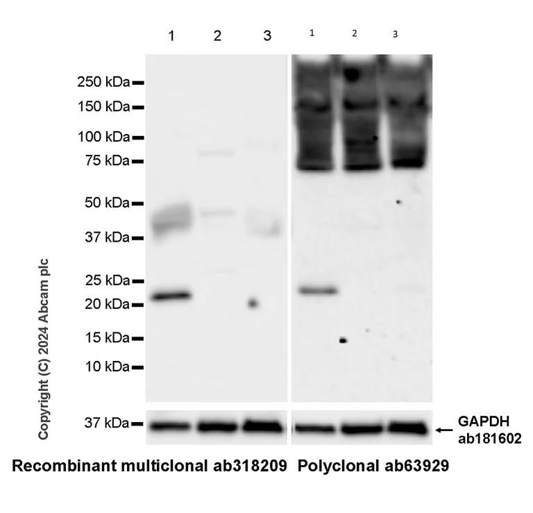 Western blot - Anti-Lipocalin-2 / NGAL antibody [RM1211] - BSA and Azide free (AB318210)