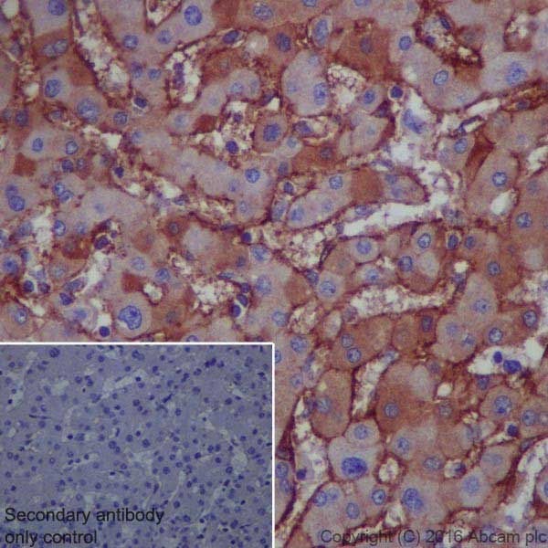 Immunohistochemistry (Formalin/PFA-fixed paraffin-embedded sections) - Anti-Lipoprotein a antibody [EPR19731] (AB208184), expandable thumbnail