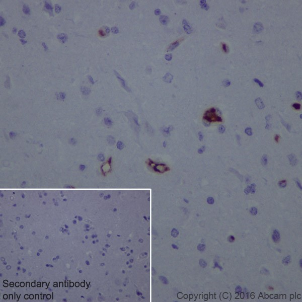 Immunohistochemistry (Formalin/PFA-fixed paraffin-embedded sections) - Anti-Lipoprotein a antibody [EPR19731] (AB208184), expandable thumbnail