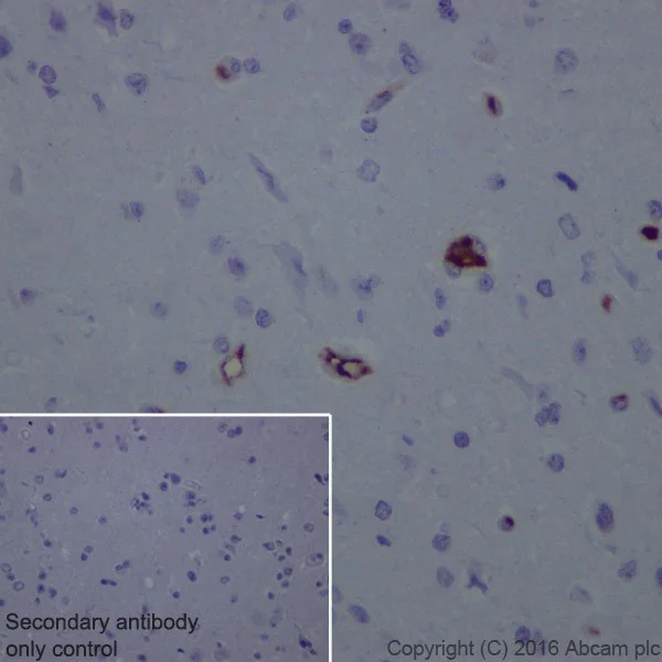 Immunohistochemistry (Formalin/PFA-fixed paraffin-embedded sections) - Anti-Lipoprotein a antibody [EPR19731] - BSA and Azide free (AB251491)
