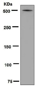 Western blot - Anti-Lipoprotein a antibody [EPR6474] - BSA and Azide free (AB240014)