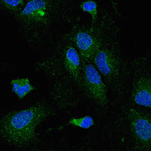 Immunocytochemistry/ Immunofluorescence - Anti-Lipoprotein lipase antibody [5D2] (AB93898)