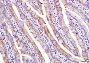 Immunohistochemistry (Formalin/PFA-fixed paraffin-embedded sections) - Anti-Lipoprotein lipase antibody (AB217200)