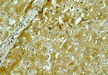 Immunohistochemistry (Formalin/PFA-fixed paraffin-embedded sections) - Anti-Lipoprotein lipase antibody [EPR1555(2)] (AB172953)