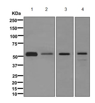Western blot - Anti-Lipoprotein lipase antibody [EPR1555(2)] (AB172953)