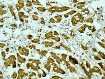 Immunohistochemistry (Formalin/PFA-fixed paraffin-embedded sections) - Anti-Lipoprotein lipase antibody [EPR1555(2)] - BSA and Azide free (AB249731)