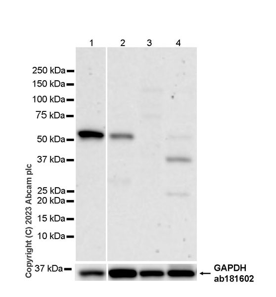 Western blot - Anti-Lipoprotein lipase antibody [EPR28301-66] (AB316008), expandable thumbnail