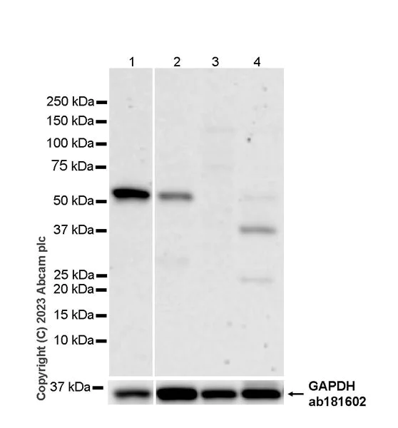 Western blot - Anti-Lipoprotein lipase antibody [EPR28301-66] - BSA and Azide free (AB316009)