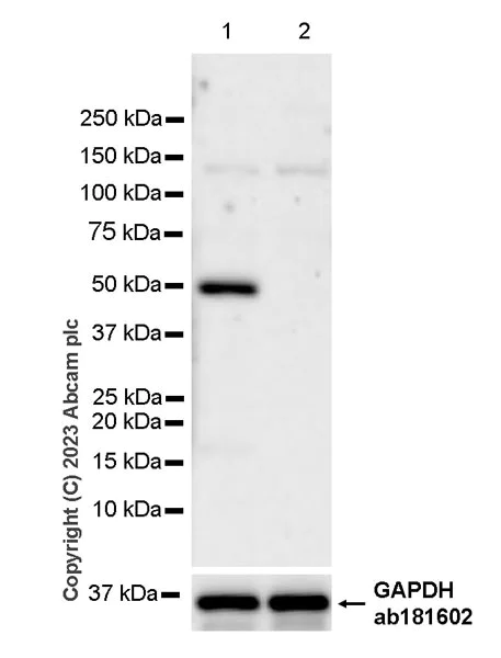 Western blot - Anti-Lipoprotein lipase antibody [EPR28301-66] - BSA and Azide free (AB316009)