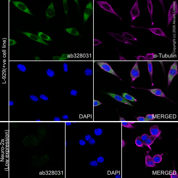 Immunocytochemistry/ Immunofluorescence - Anti-Lipoprotein lipase antibody [EPR31098-680] (AB328031)