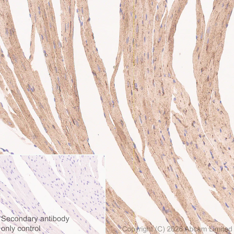 Immunohistochemistry (Formalin/PFA-fixed paraffin-embedded sections) - Anti-Lipoprotein lipase antibody [EPR31098-680] (AB328031)