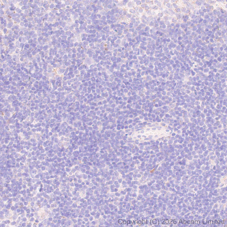 Immunohistochemistry (Formalin/PFA-fixed paraffin-embedded sections) - Anti-Lipoprotein lipase antibody [EPR31098-680] (AB328031)