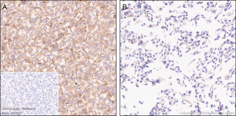 Immunohistochemistry (Formalin/PFA-fixed paraffin-embedded sections) - Anti-Lipoprotein lipase antibody [EPR31098-680] (AB328031)