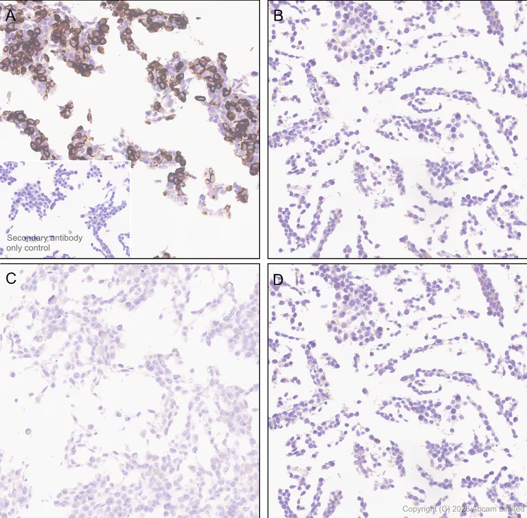 Immunohistochemistry (Formalin/PFA-fixed paraffin-embedded sections) - Anti-Lipoprotein lipase antibody [EPR31098-680] (AB328031)